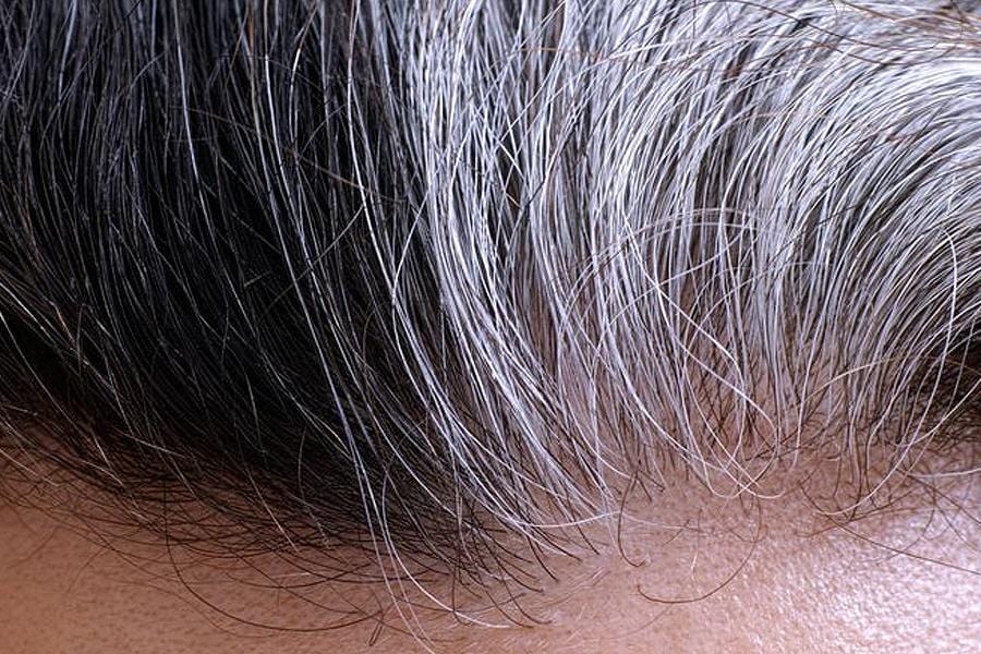 Evita la aparición de canas con estos sencillos remedios